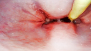 EXTRAORDINAIRE. CAMERA INWARDS HER VULVA WHILE I CRAM HER WITH JIZZ